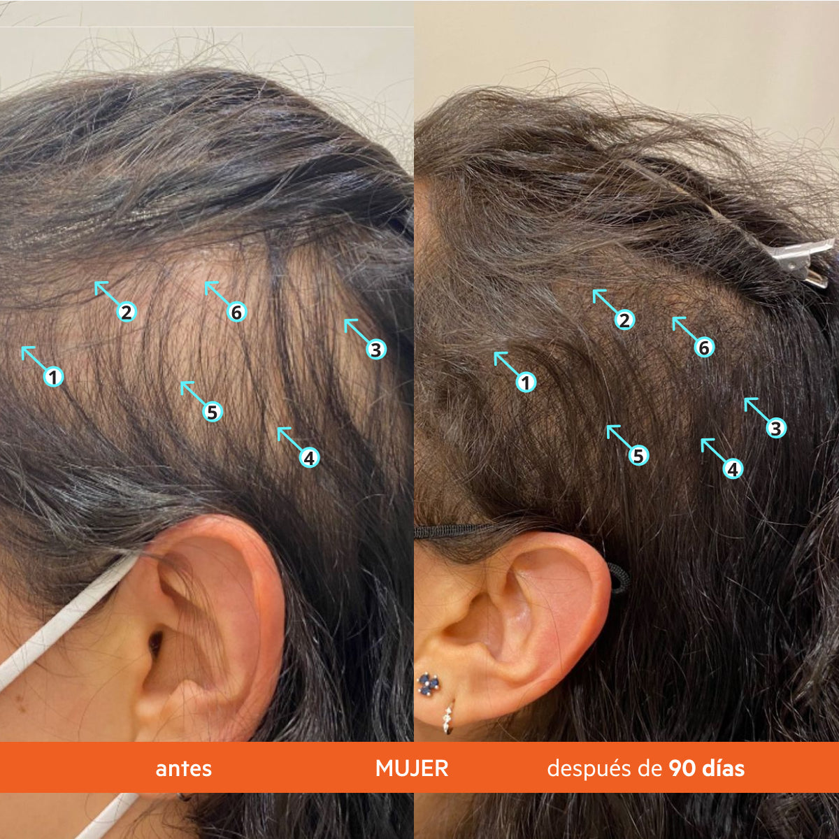 Naturae® Champú Anticaída Estimulante del Cabello