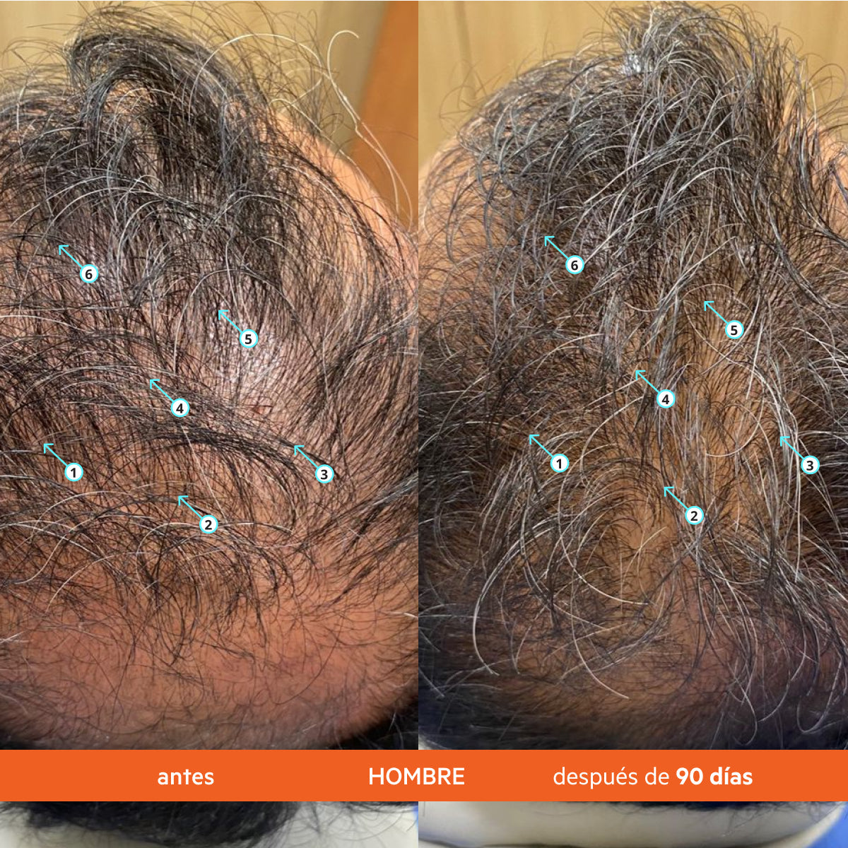 Naturae® Champú Anticaída Estimulante del Cabello