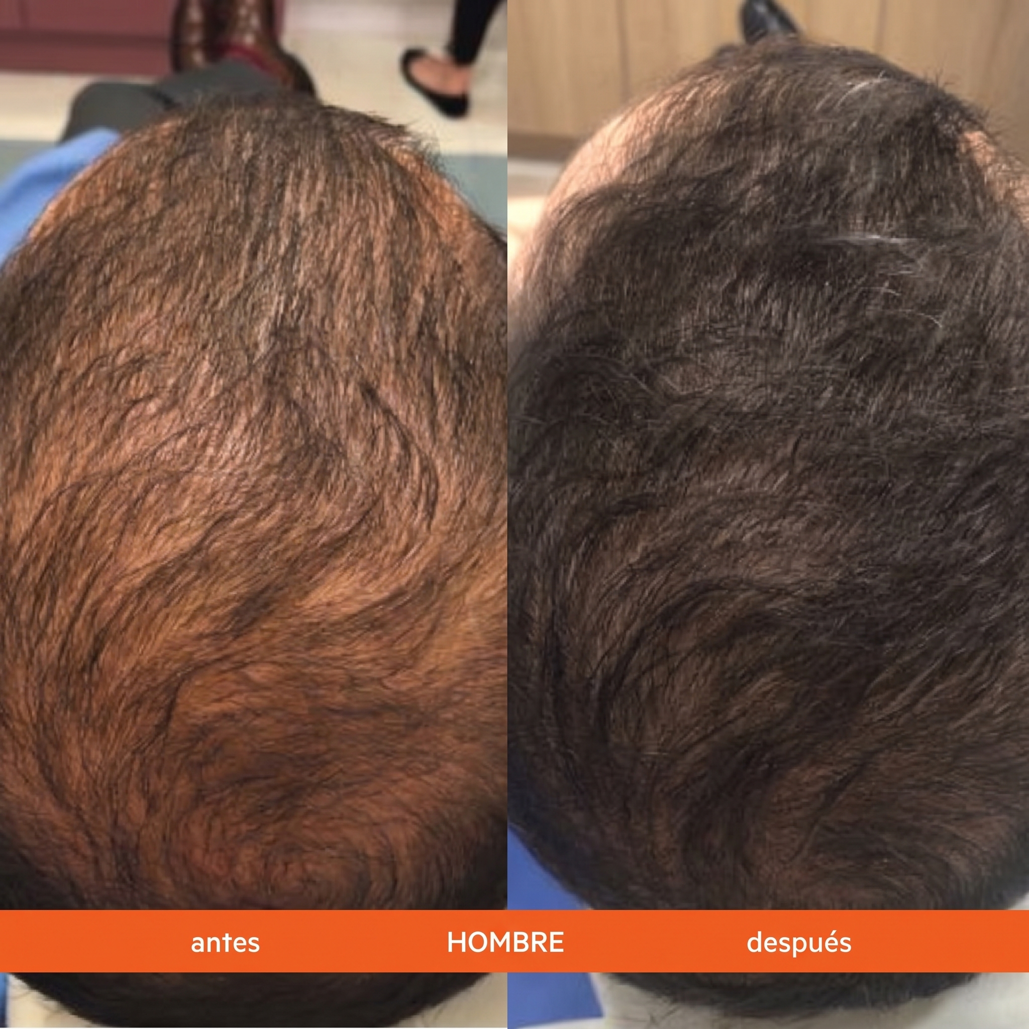 Naturae® Champú Anticaída Estimulante del Cabello